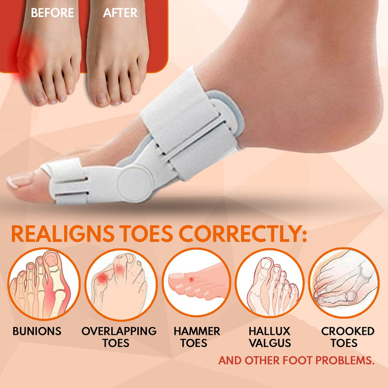 [Australia] - Bunion Corrector and Bunion Relief Orthopedic Bunion Splint Pads for Men and Women Hammer Toe Straightener and Bunion Protector Cushions- Relieve Hallux Valgus Foot Pain and Soothe Sore Bunions 