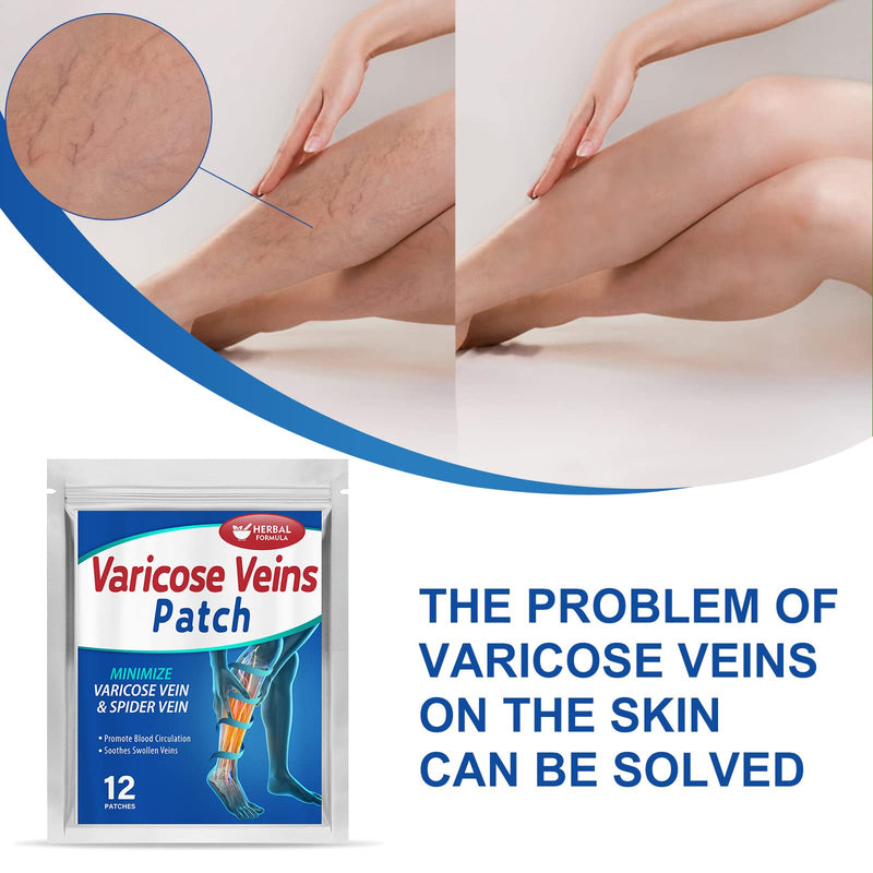 [Australia] - Memonotry Varicose Veins Treatment for Legs, Varicose Veins Patches, Relief Phlebitis Angiitis Inflammation, Improve Blood Circulation for Strengthen Capillary Health, Brown 12 