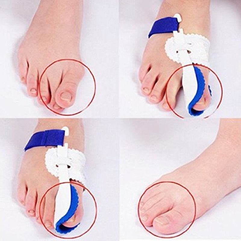 [Australia] - Careforyou® Night Time Splint Big Toe Straightener Bunion Hallux Valgus Corrector Regulator Stretcher Support Separators Foot Care Pain Relief 