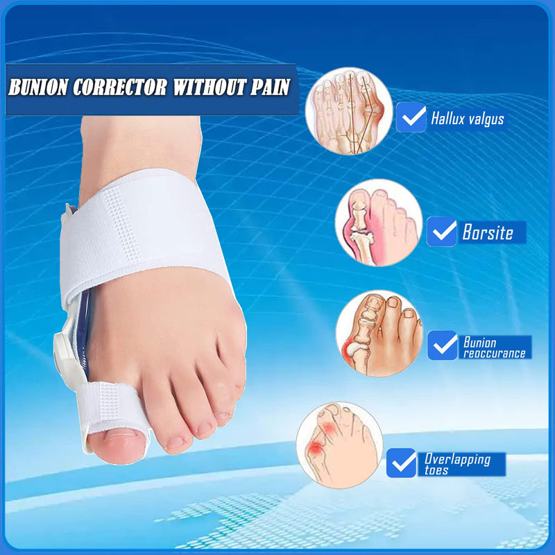 [Australia] - Paskyee Bunion Corrector, Orthopedic Bunion Toe Straightener for Women and Men 2 PCS, Adjustable Bunion Splint with Toe Separator for Bunion Relief White 