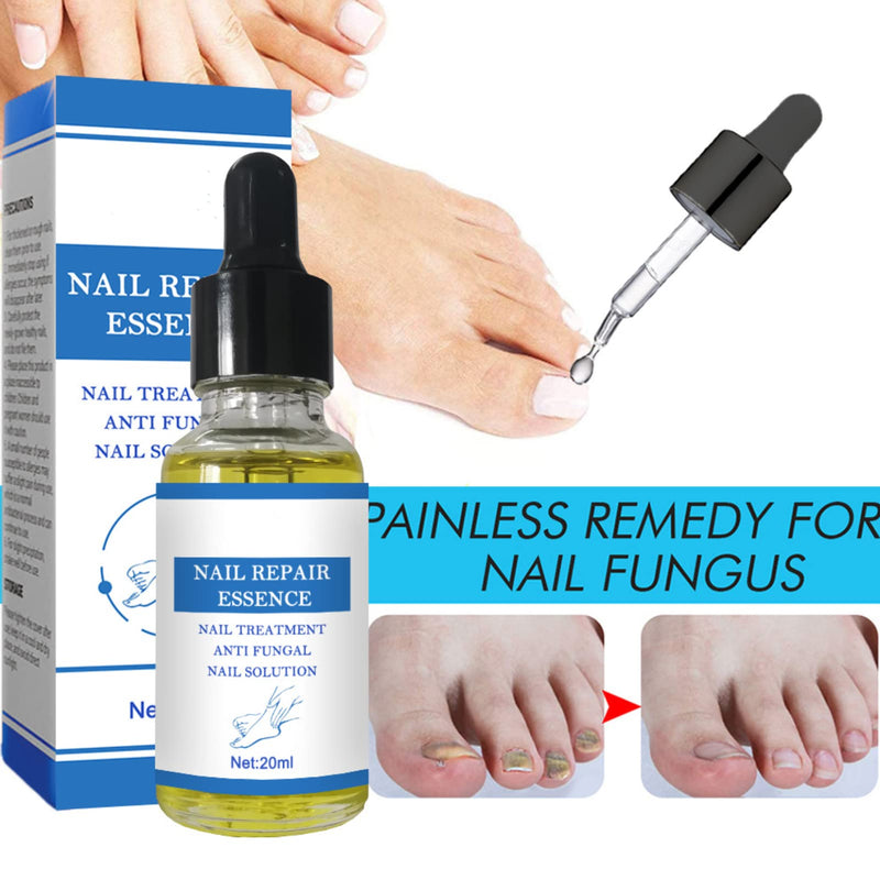 [Australia] - Nail Fungus Treatment ,Fungal Nail Treatment for Toenail,Toenail Fungus, Nail Fungus, Antifungal Toenail Treatment,Nail Repair Fungal Nail Solution 