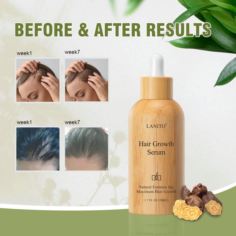 [Australia] - LANITO Hair Growth Serum with Radix Polygonum Multiflorum Root Extract for Hair Thinning, Hair Fall & Healthy, Scalp Hair Thickening Products for Woman Man 50 ML 1.69OZ 