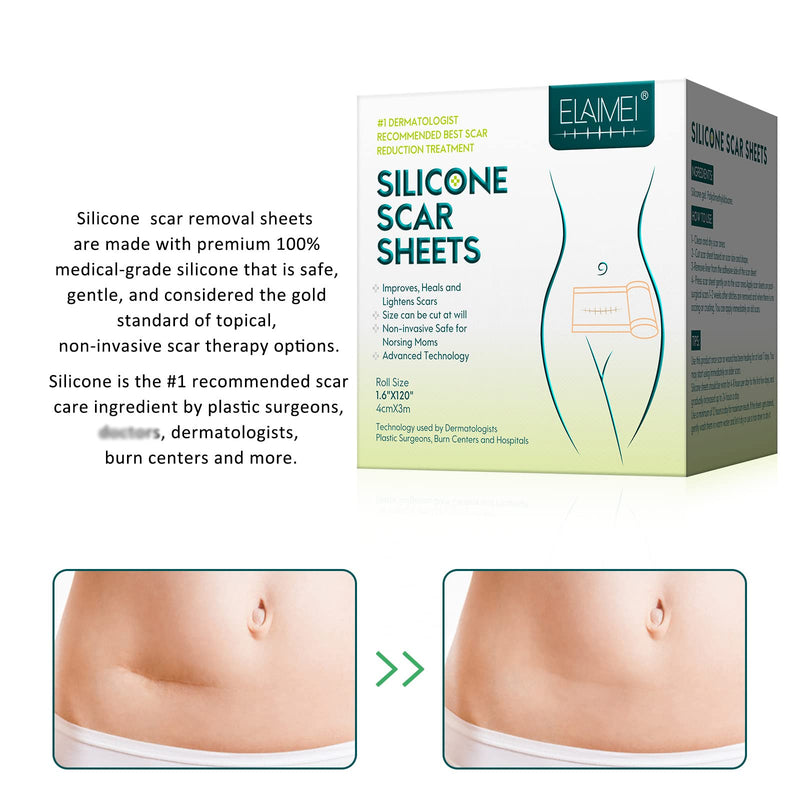 [Australia] - Silicone Scar Sheets, Professional Silicone Scar Removal Sheets, Silicone Easy-Tear Gel Tape Roll for Old & New Scars, Professional Scar Tape 3m 