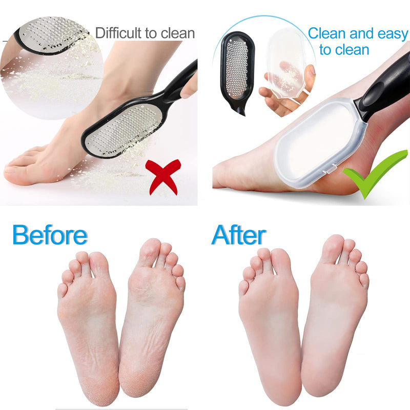 [Australia] - Sularpek Foot File, Foot Scraper, Best Foot Care Pedicure Metal Surface Tool to Remove Hard Skin Can Be Used on Both Wet and Dry Feet, Surgical Grade Stainless Steel File 