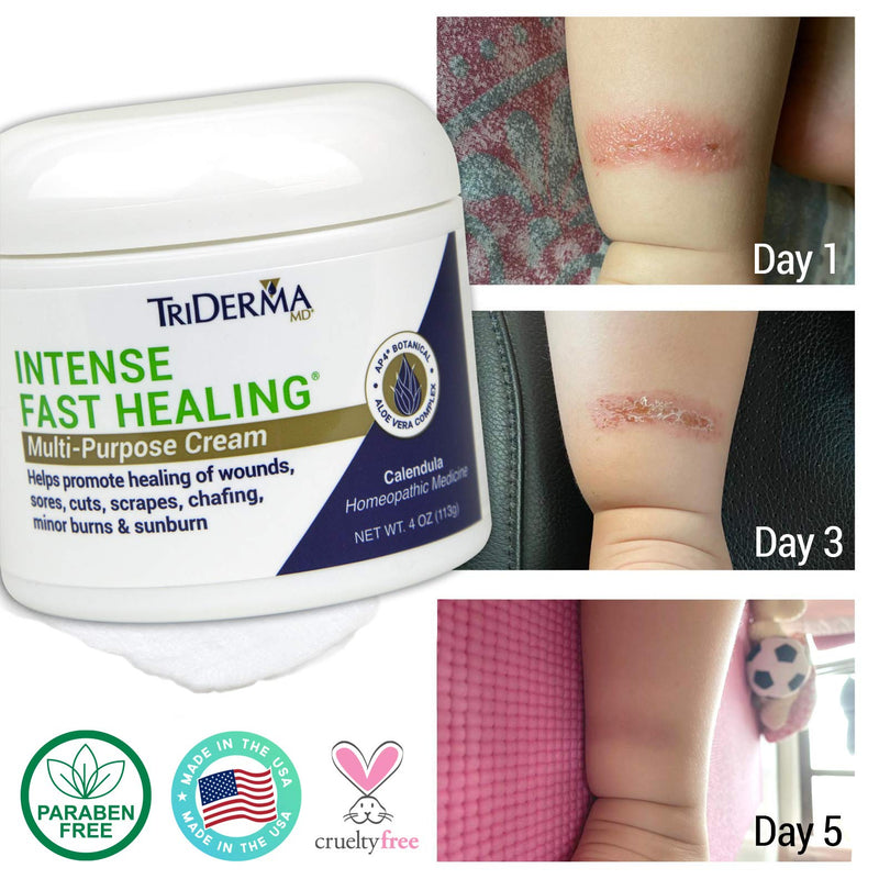 [Australia] - TriDerma Intense Fast Healing Cream, Decreases Healing Time for Minor Irritations, Rashes, Wounds, Cuts, Scrapes, Value Pack of 2 - 4 Ounce Jars 