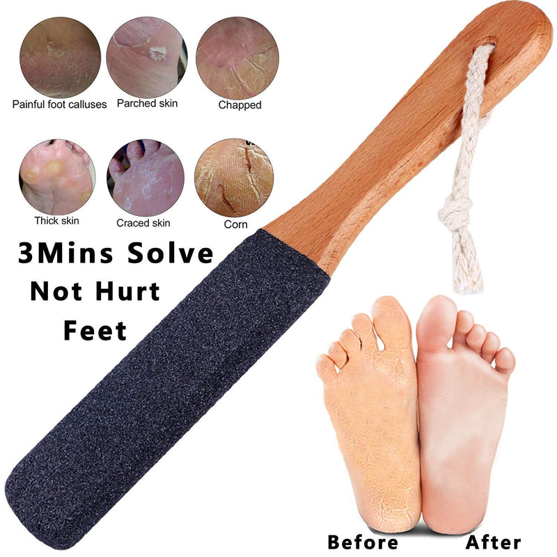 [Australia] - Vridale Pumice Stones for Feet Lava Pumice Stone Foot File Callus Removal Foot Scrubber for Hands Care Foot Exfoliation Dead Skin Remover with Handle 