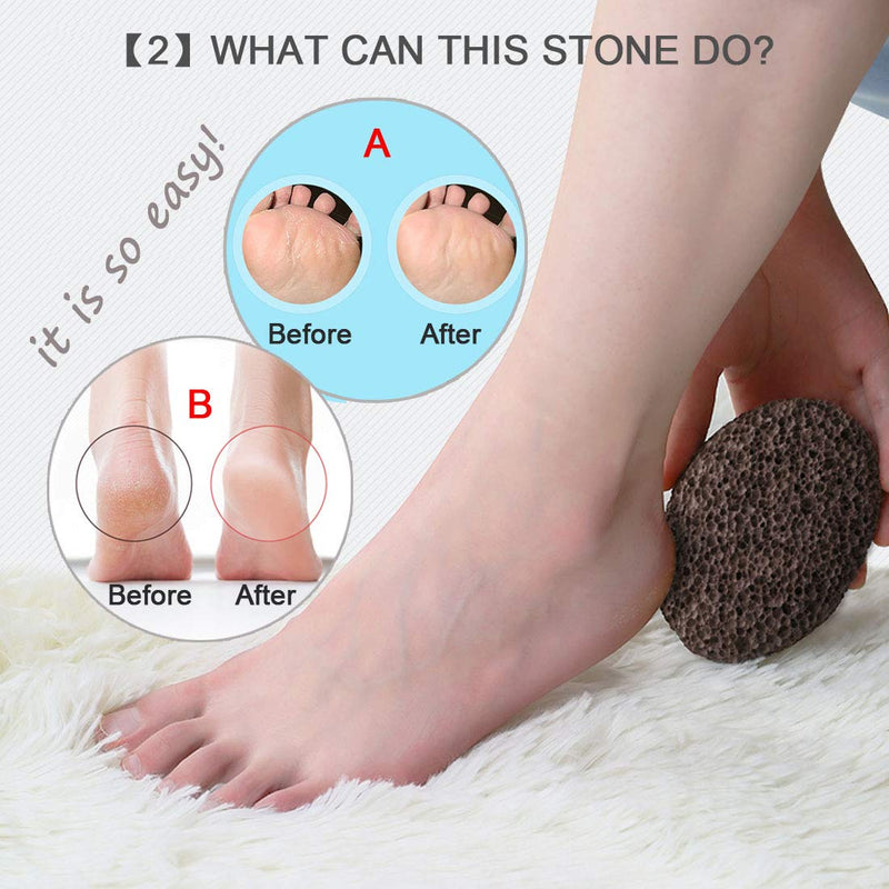 [Australia] - Natural Volcanic Lava Pumice Stone Foot and Hand Skin Pedicure Callus Dead Skin Remover(Brown) 