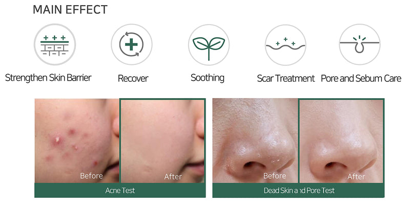 [Australia] - SOME BY MI AHA. BHA. PHA 30 Days Miracle Cream, 60 g, Mild Skin Barrier Cream, Acne-Fighting, for Sensitive Skin, Calming, Cleanse + Protect Skin, Anti-wrinkle, Natural Ingredient, Korean Skin Care 