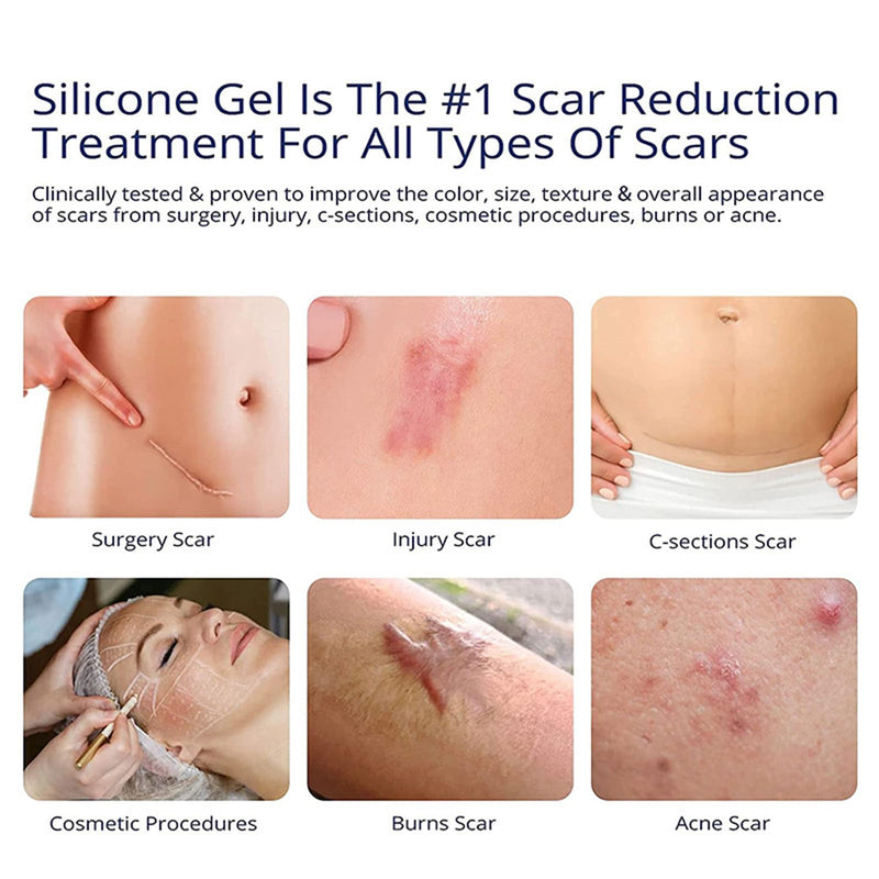 [Australia] - Silicone Scar Gel - Scar Gel Cream - Scar Treat Gel - Scar Removal Cream for C-Section, Stretch Marks, Acne, Surgery, Effective for Both Old and New Scars 