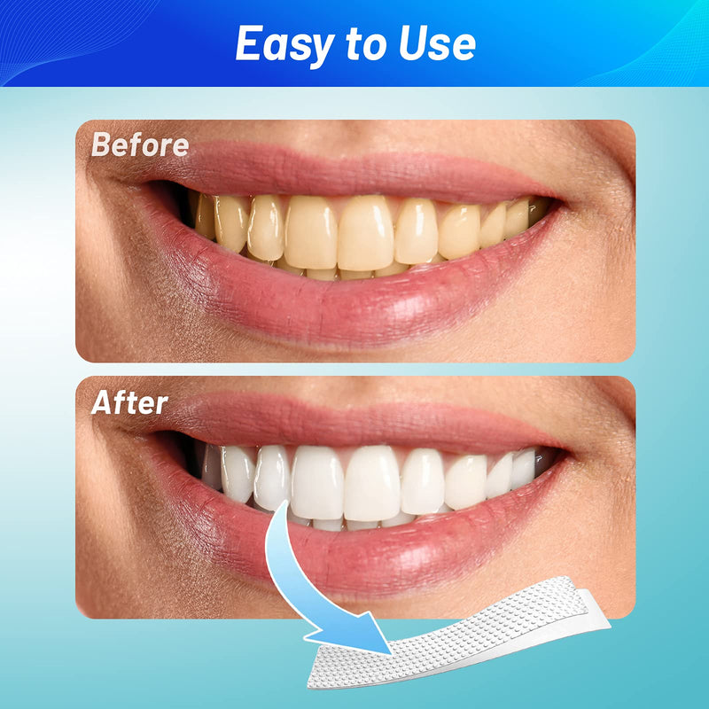 [Australia] - Teeth Whitening Strips 5D, YTOOK Tooth Whitening Kits for Sensitive Teeth - Gentle for Enamel and Gums, Teeth Whitener Removes Coffee Tea Smoking & Wine Stains 