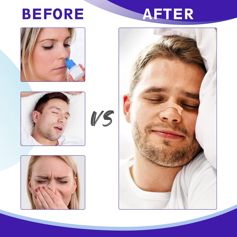 [Australia] - Nasal Strips Extra Strength, 120 Pack (2.6*0.7inch), Works Instantly to Improve Sleep, Reduce Snoring and Relieve Nasal Congestion, for Women Men 