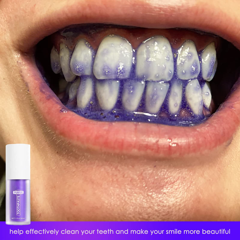 [Australia] - Purple Toothpaste for Teeth Whitening, Purple Tooth Whitening Toothpaste Gel Stain Removal for Yellow Teeth, Purple Whitening Toothpaste Suitable for Sensitive Teeth and Teeth Cleaning Toothpaste 