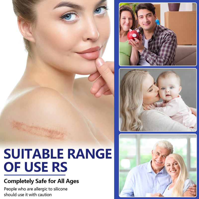 [Australia] - Advanced Silicone Scar Sheets, Transparent Strips, Gel Tape for Scar Removal, Reusable and Effective Removal New and Old Scars(4X300CM Roll) Blue 