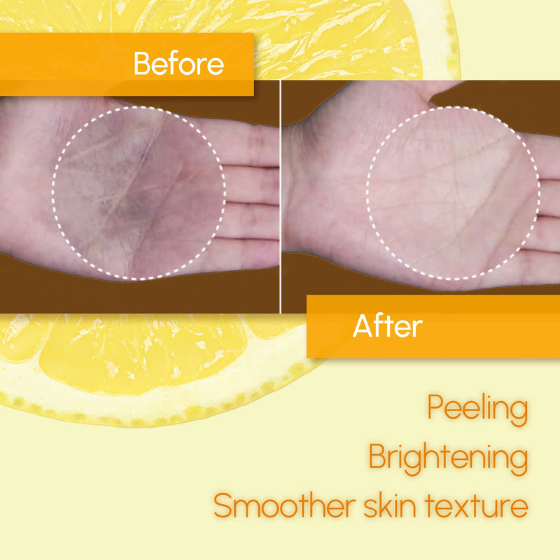 [Australia] - Neogen Dermalogy Bio Peel Gauze Peeling Lemon (200 ml/30pads) Premium exfoliating pads 