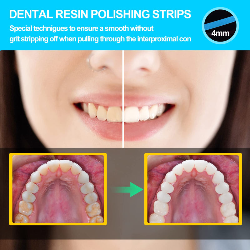 [Australia] - AISEELY Dental Polishing Strips, 1Pc Whitening Strip, 4mm Tooth Sandpaper Thickness Teeth Resin Tooth Interdental Grinding Tool, 6m/Rolls/Box (Blue-Fine) Blue 