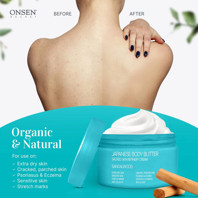 [Australia] - Onsen Japanese Body Butter for Women - Skin Refinery Cream Natural and Organic Shea Butter Moisturizing Clear Skin Exfoliator with Coconut Oil and Vitamin E - 8.6 fl oz / 255 ml (Sandalwood) Sandalwood 