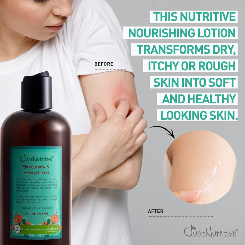 [Australia] - Skin Calming & Healing Lotion | Organic Moisturizer for Treatment of Dry, Cracked or Irritated and Itchy Skin | Eczema Lotion Provides Long-lasting Relief | Just Nutritive | 16 Oz 