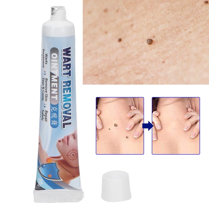 [Australia] - Wart Remover Cream, Wart Remover Nourishing Corn Plantar Plane for Daily Use, Wart Treatment Cream Pain Relief 
