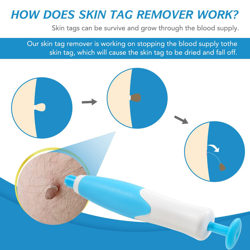 [Australia] - 2 in 1Skin Tag Removal,Skin Tag Remover Kit, Skin Tag Removal Pen Face Care Mole Wart Tool Patches,Fast Effective & Safe Painless 