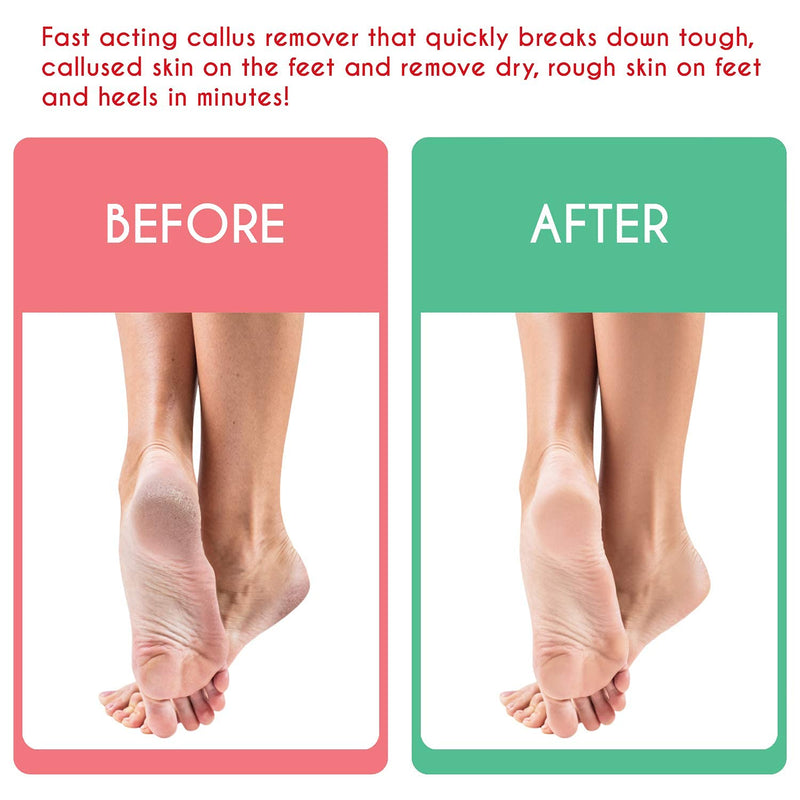 [Australia] - Tachibelle Callus Remover ULTRA Scent For Feet, Professional Strong Callus and Corn Eliminator Feet Pumice Dead Skin Heel and Toe (2 Bottles) 2 Bottles 