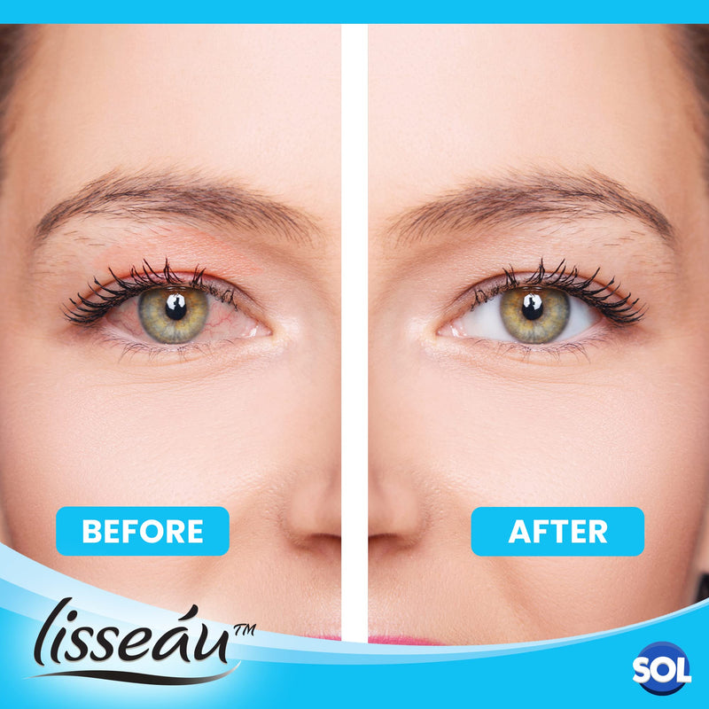 [Australia] - 2pk Eye Spray | Dry Eye Spray | Dry Eyes Treatment | Eye Spray for Tired and Dry Eyes | Eye Mist | Eye Spray for Itchy Eyes | Eye Mist Spray for Dry Eyes | Itchy Eye Spray 