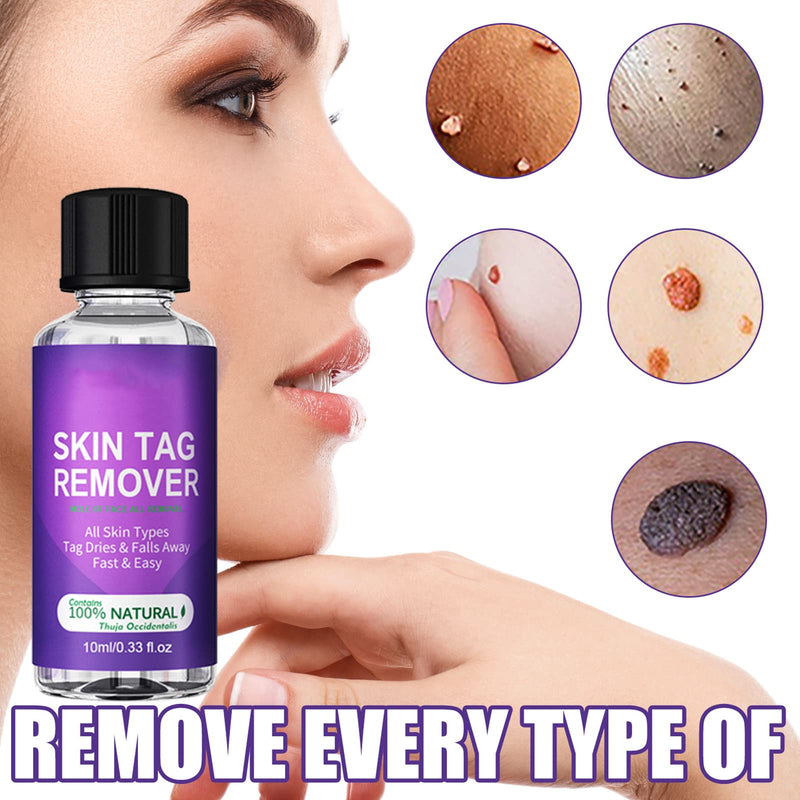 [Australia] - Natural Ingredients Skin Tag Removal,Skin Tag Removal & Natural Repair Gel,Wart & Mole Remover,Repair Lotion Set,Easy to Use at Home 