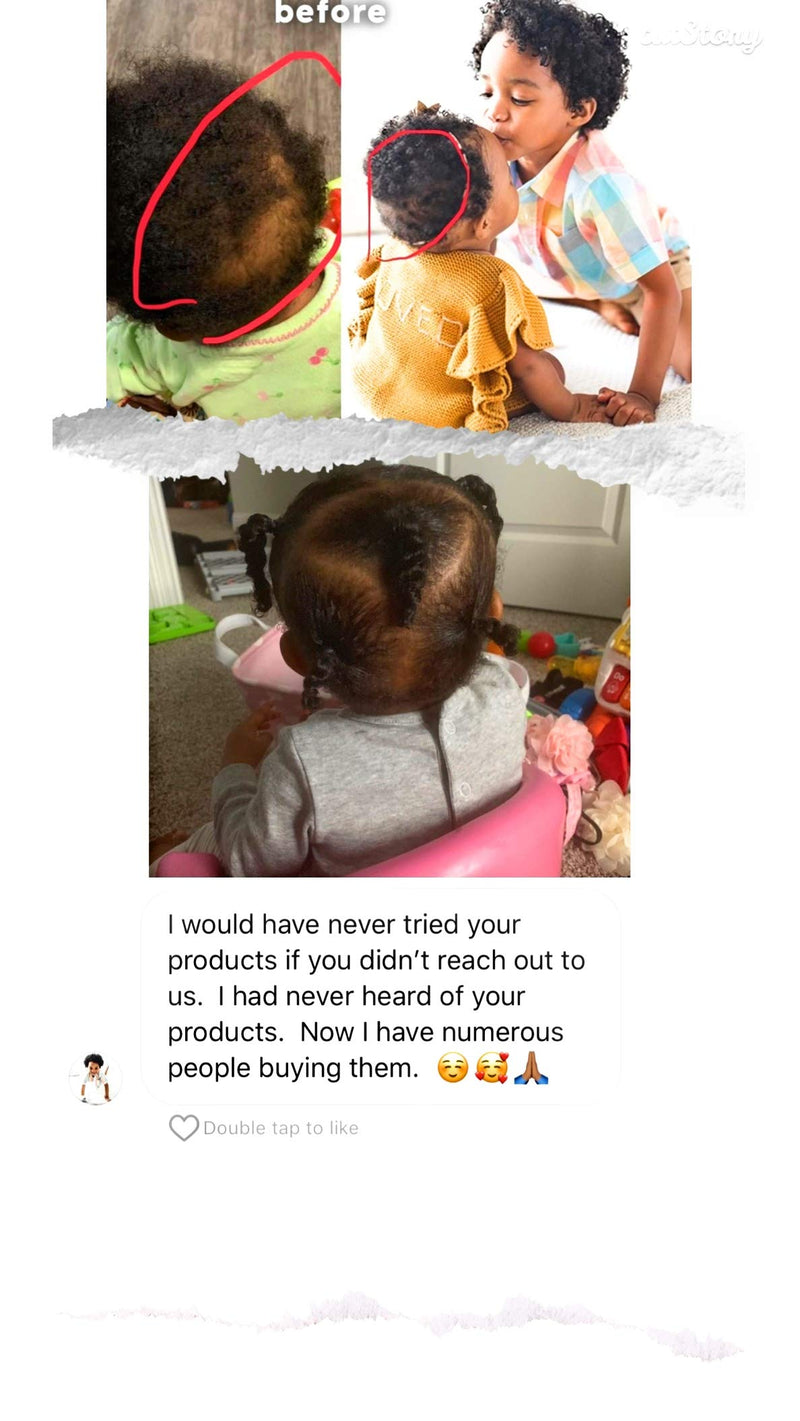 [Australia] - J‚ÄôOrganic Solutions Biotin hair growth Stimulating Conditioner (for kids) with Argan Oil, Aloa Vera & more 