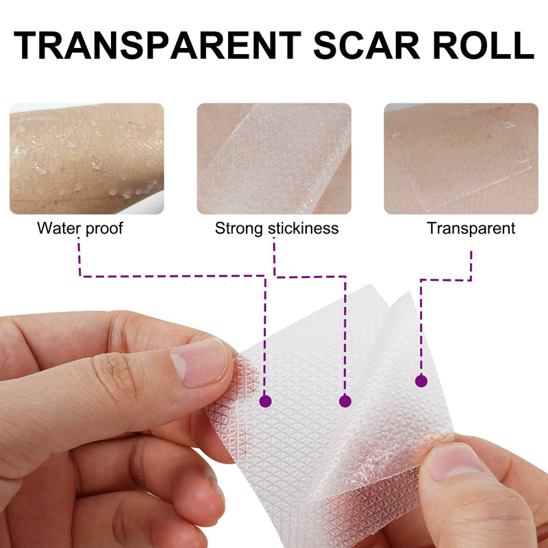 [Australia] - Silicone Scar Tape for Scar Treatment, Advanced Scar Removal Sheets, Soften and Flatten Old Scars and New Scars Which Resulting from Surgery, Acne, Injury, Burns, C-Section and More (4cm x 1.5m) 