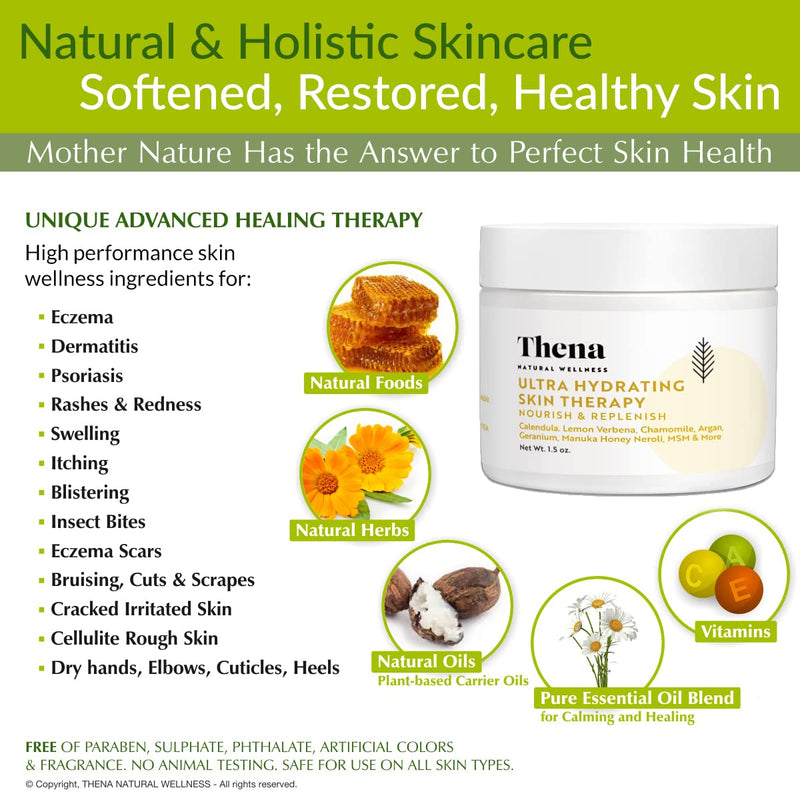 [Australia] - Ultra Hydrating Skin Cream For Eczema Treatment Scalp Psoriasis Dry Itchy Skin Rosacea Rashes Seborrheic Dermatitis Natural Organic Moisturizing Ointment Lotion (1.5 ounce) 1.5 Ounce 