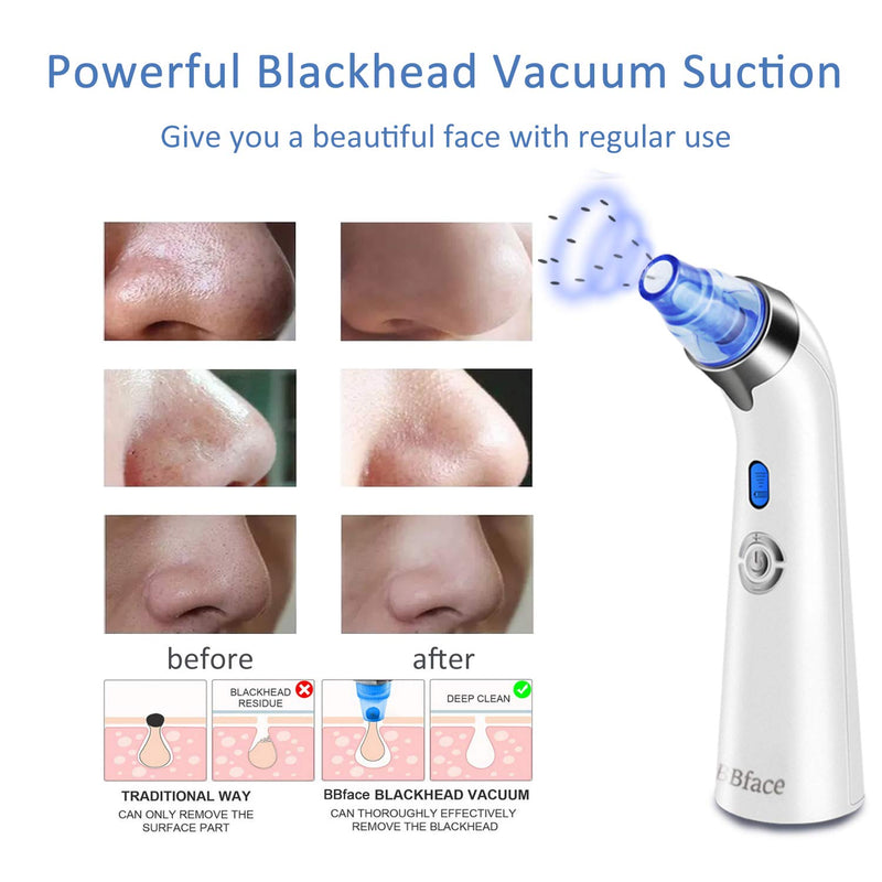[Australia] - Blackhead Remover Vacuum, Electric Blackhead Remover Pore Vacuum Facial Suction Cleaner Tool with 4 Replaceable Suction Probes(Blue) blue 