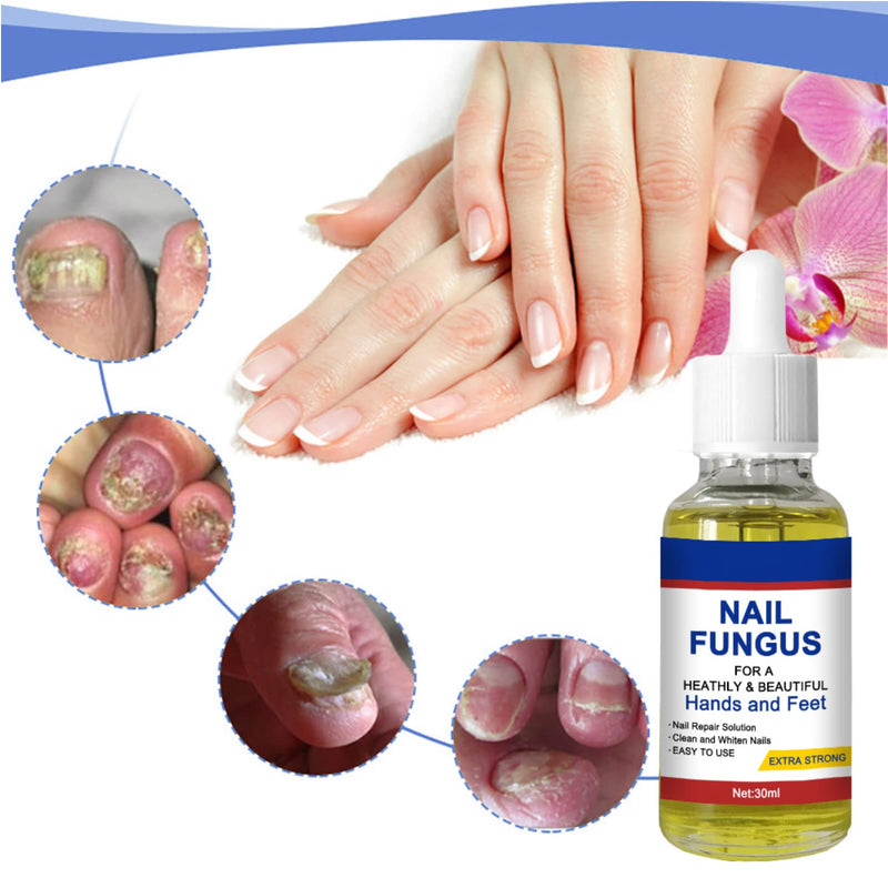 [Australia] - Nail Fungal Treatment, Toenail Treatment Extra Strong Nail Repair Set, Fingernail Toenail Care, Fix Renew Damaged, Broken, Anti Fungus Nail Repair 