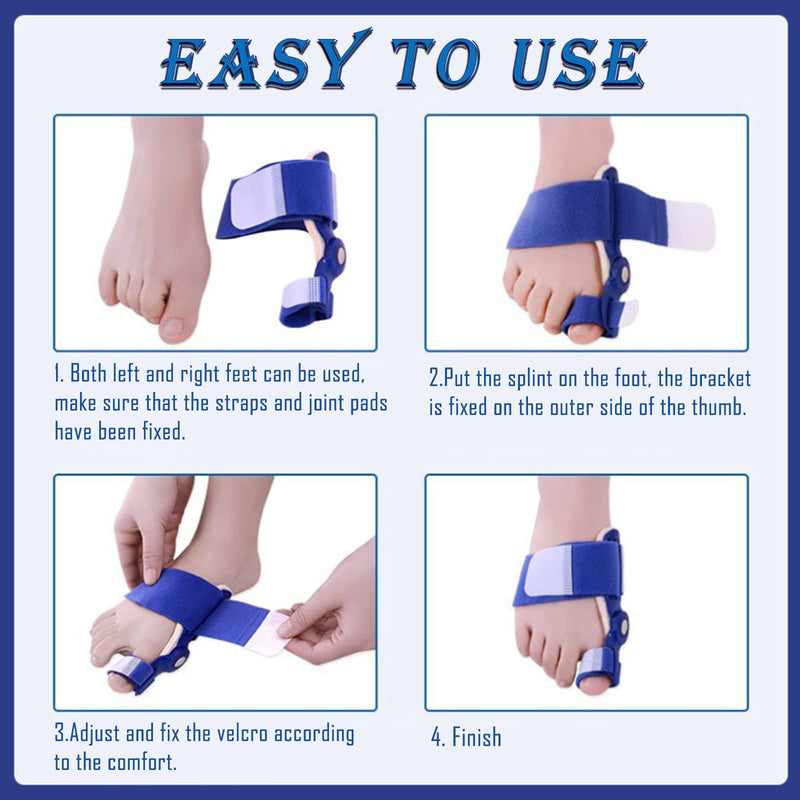 [Australia] - Paskyee Bunion Corrector, Orthopedic Bunion Toe Straightener for Women and Men 2 PCS, Adjustable Bunion Splint with Toe Separator for Bunion Relief Blue 