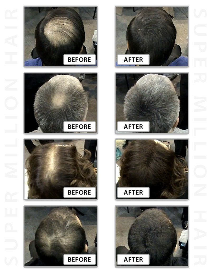 [Australia] - Super Million Hair - 1 x 25g Hair Building Fibres - No.7 Wheat Blonde 