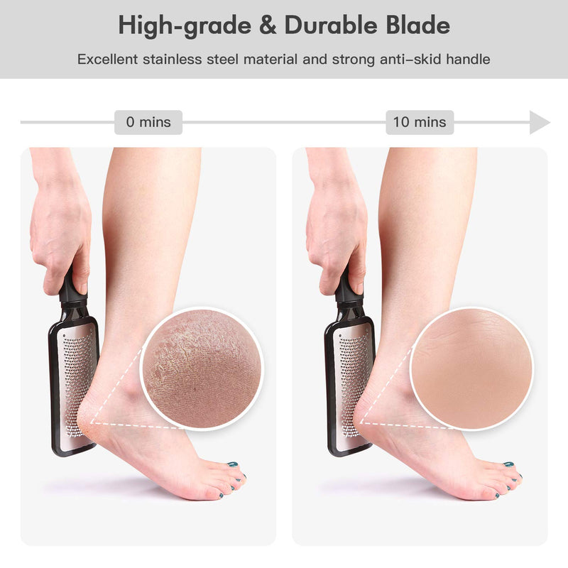 [Australia] - NIUTA 【Factory Direct】 Colossal Foot Rasp Foot Scrubber And Callus Remover，Surgical Grade Stainless Steel Foot File, Can Be Used On Trimming Dead Skin, Callus ect, Black 