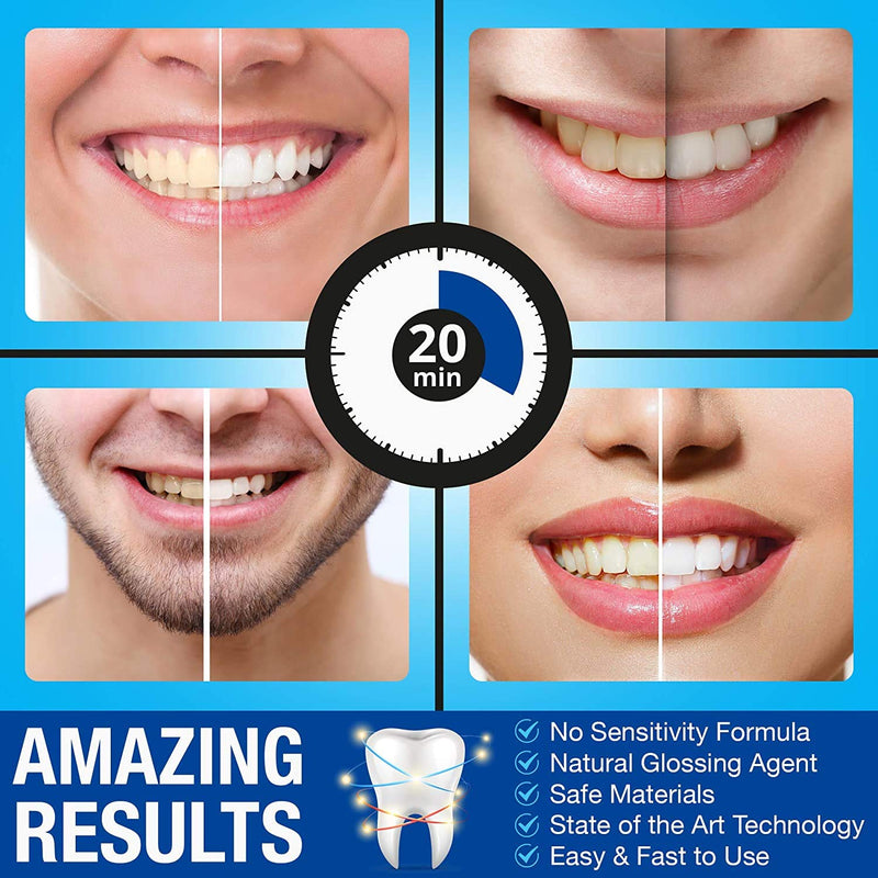 [Australia] - Teeth Whitening Kit with LED Light - Pro Intellident Advanced Gel & Stain Remover - Longer Lasting Results Than Whitening Strips or Activated Charcoal - Ideal Tooth Whitener for Sensitive Teeth Teeth Whitening Kit 