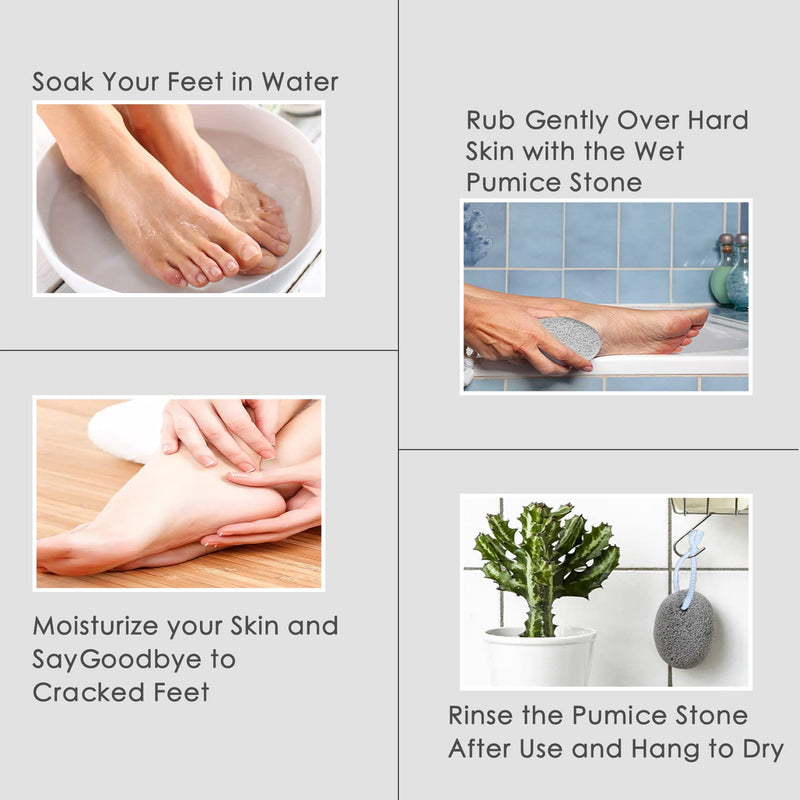 [Australia] - Pumice Stone 2 Pcs - Foot Pumice Stone for Feet Hard Skin Remover, Foot Scrubber Stone for Dead Skin, Calluses and Corns 