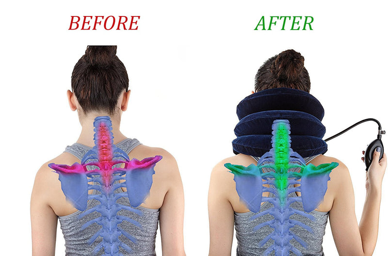 [Australia] - Cervical Neck Traction Device Inflatable Neck Stretcher, Easy to Use for Chronic Neck and Shoulder Pain Relief, Neck Cervical Brace Collar Pillow for HOM Blue 