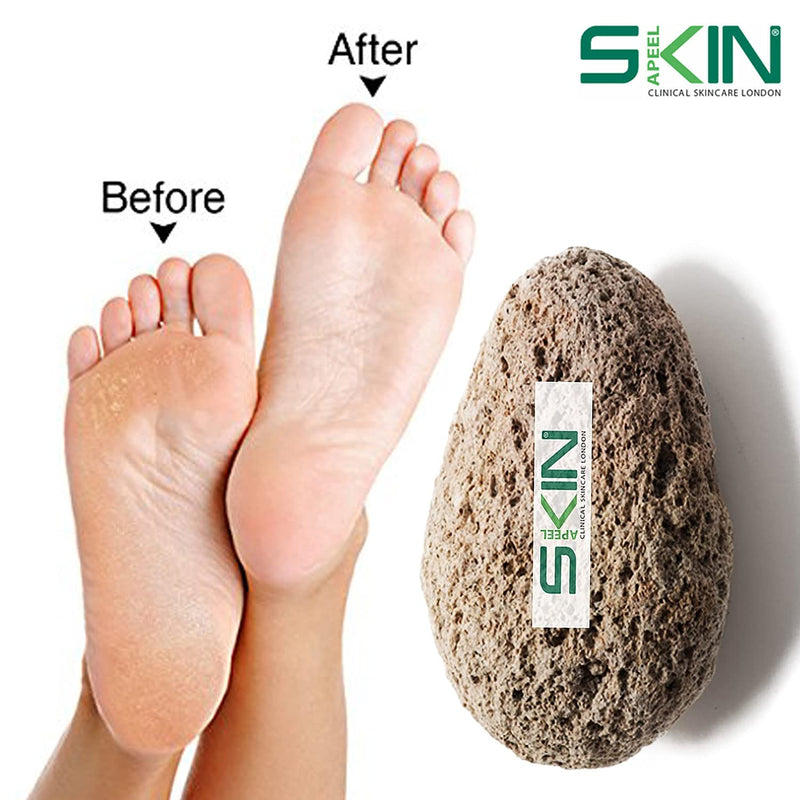 [Australia] - Skinapeel Large Pumice Stone - Natural Foot Care Scruber - Dead Hard Skin Callus Remover - Pedicure Tool - Skinapeel UK Skincare Specialists 