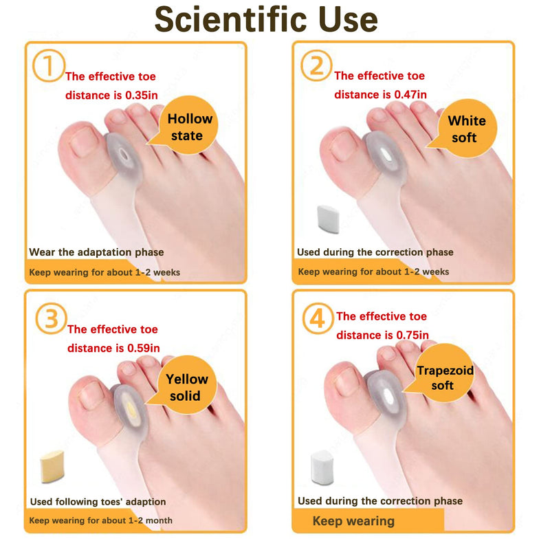 [Australia] - Toe Separators Gel- Big Toe Spacers - Bunion Corrector and Bunion Relief - Pads for Overlapping-Corrector and Spacer 