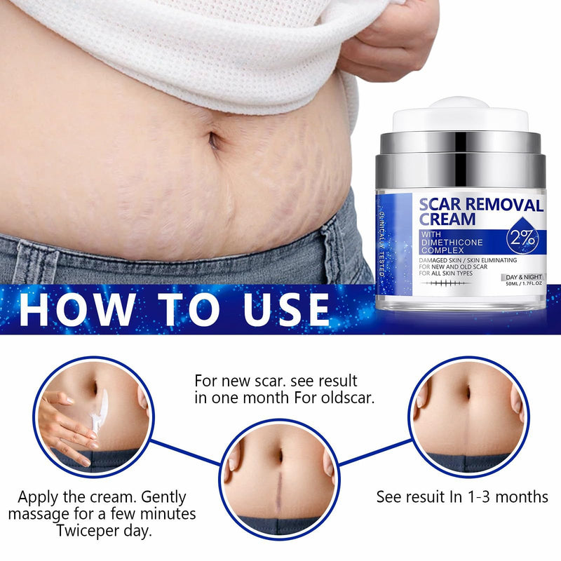 [Australia] - Scar Removal Cream - Rapid Repair of New and Old Scars - Scar Removal and Soothing Cream for Surgical Scars, Acne Scars, C-Section, Burns, Stretch Marks 