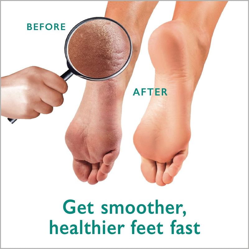 [Australia] - Callus Remover Gel + Foot Scrubber Kit - Pedicure Tools for Dry Cracked Heels 