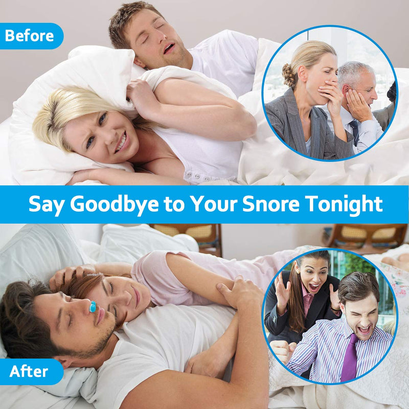 [Australia] - Anti Snoring Devices - Effective Snore Stopper for CPAP Users, Anti Snore Nasal Dilators Nose Vents Plugs for Stop Snoring,Snoring Solution Relieve Snore Better Sleep Devices That Work for Women Men 2PCS Anti Snoring Devices 