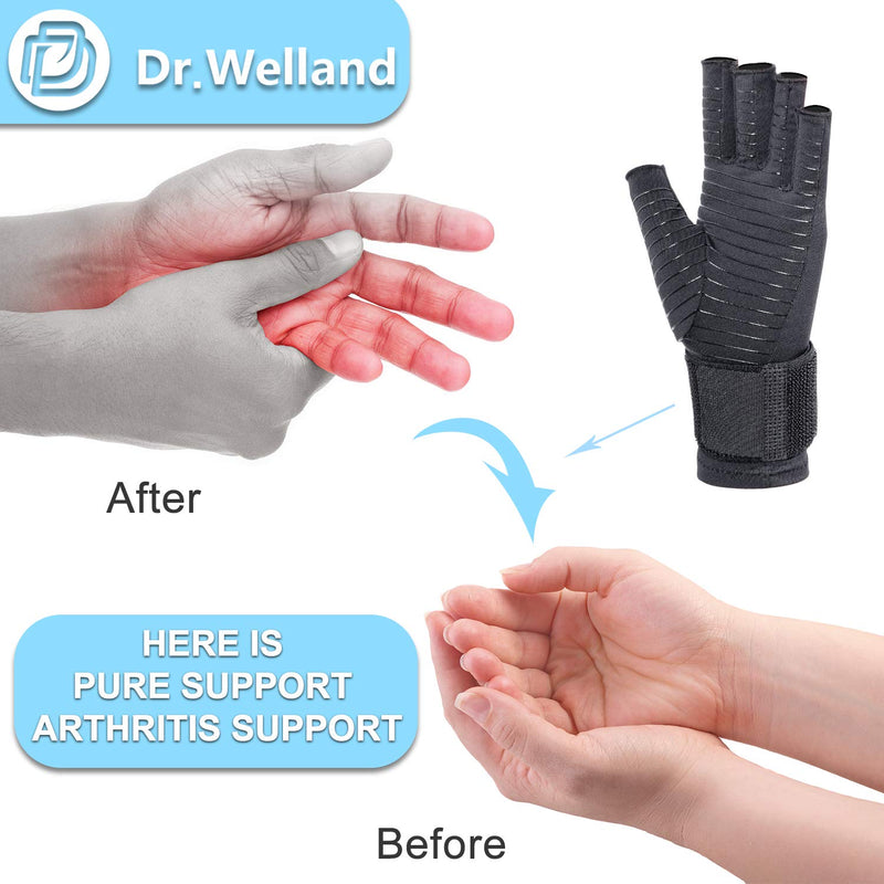[Australia] - Dr.Welland Medical Arthritis Gloves with Strap, Best Open Finger Glove Hand Wrist Support for Rheumatoid Arthritis, Carpal Tunnel, RSI, Tendonitis, Daily Healing, Hand Pain Relief – Men/Women Small/Medium (2 Count) 