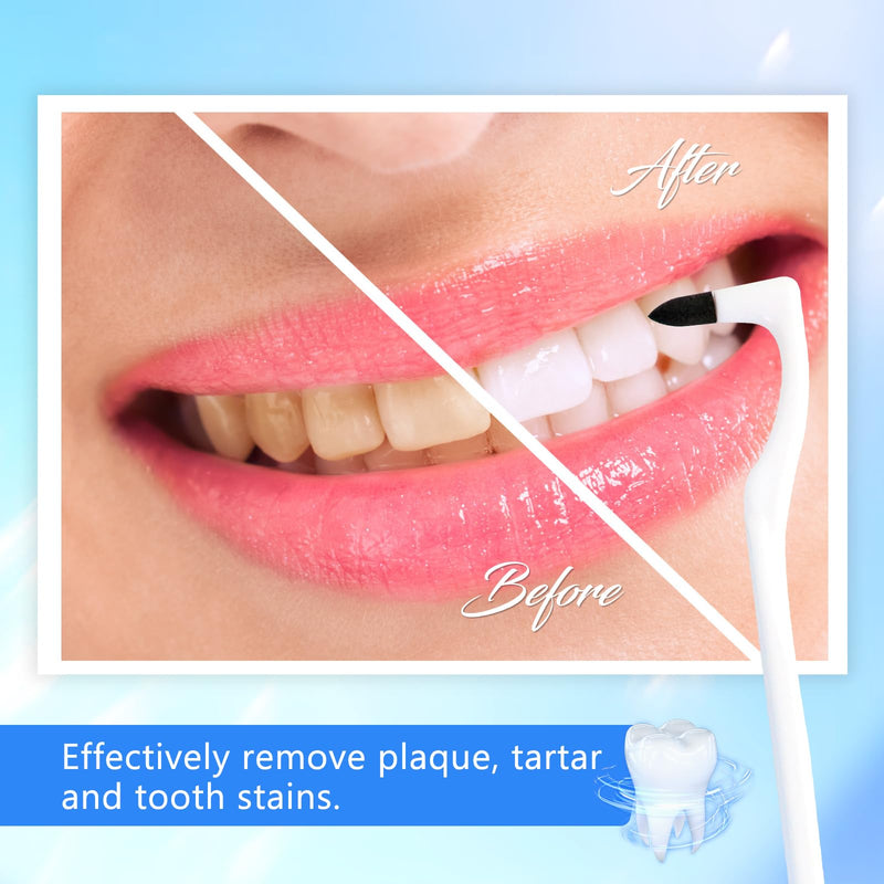 [Australia] - Sularpek 3 PCS Tartar Remover, Teeth Cleaning Kit,Plaque Remover for Teeth, for Removing Plaque & Stain (White & Blue&Grey) 
