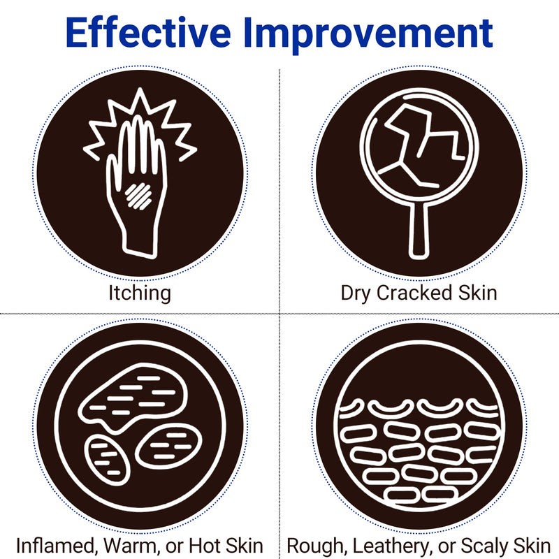 [Australia] - LMNOOP Eczema Cream for Dry, Itchy, Irritated, and Eczema Prone Skin, Maximum Strength Treatment Ointment for Rash, Psoriasis, Dermatitis, Beriberi (3.53oz) 3.53 Ounce 