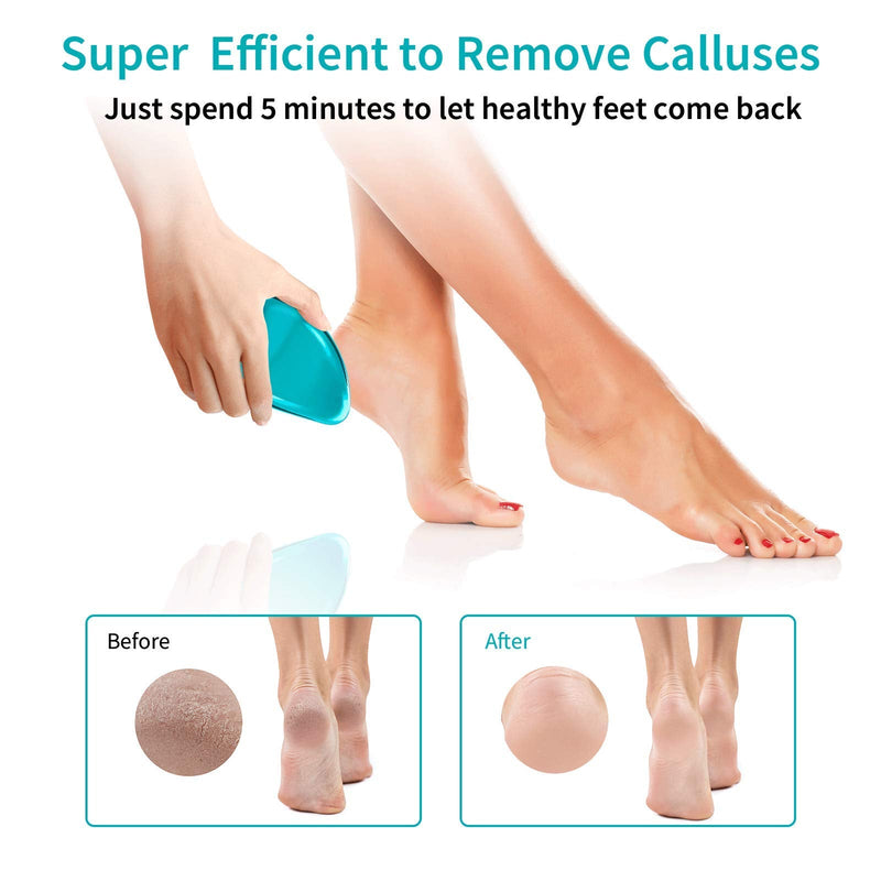 [Australia] - Foot File, Nano Glass Hard Skin Callus Remover, Foot Scraper Salon Home Pedicure Tool for Foot Beauty Care, Can Be Used on Both Wet/Dry Cracked Feet, Foot Rasp by AnjoCare 1 Count (Pack of 1) 