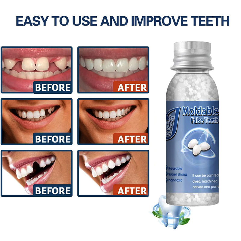 [Australia] - Tooth Repair Moldable,Teeth Filling Beads,Tooth Repair Beads,Teeth Filling Replacement,Temporary Tooth Repair Beads,Dental Tooth Beads,Dental Tooth Filler,Snap On Instant and Confident Smile,10ML 