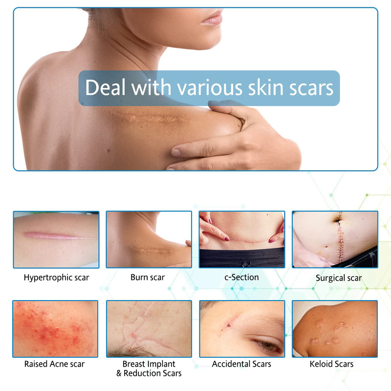 [Australia] - Reusable Silicone Scar Sheets(1.6”x 60”Roll-1.5M),Silicone Scar Roll,Scar Silicone Tape Strips,Professional Scar Removal Sheets for C-Section, Surgery, Burn, Keloid, Acne 1.6'X60' 