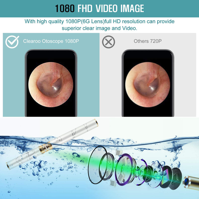 [Australia] - Ear Wax Removal Tool Wireless Earwax Cleaning Camera Visual Ear Cleaning Tool Otoscope Ear Wax Removal Endoscope for Adults Kids Pets Ear Wax Remover Suitable for iOS & Android Ear Pick Care Products 
