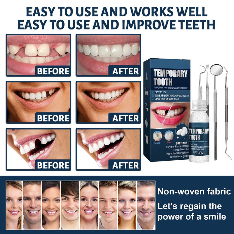 [Australia] - Tooth Repair Kit - Temporary Fake Teeth Replacement Kit with Dental Mirror Tools for Temporary Restoration of Missing & Broken Teeth Replacement Dentures 